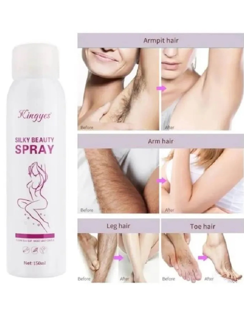 Kingyes Silky Beauty Quick & Painless Hair Removal Spray -150ml